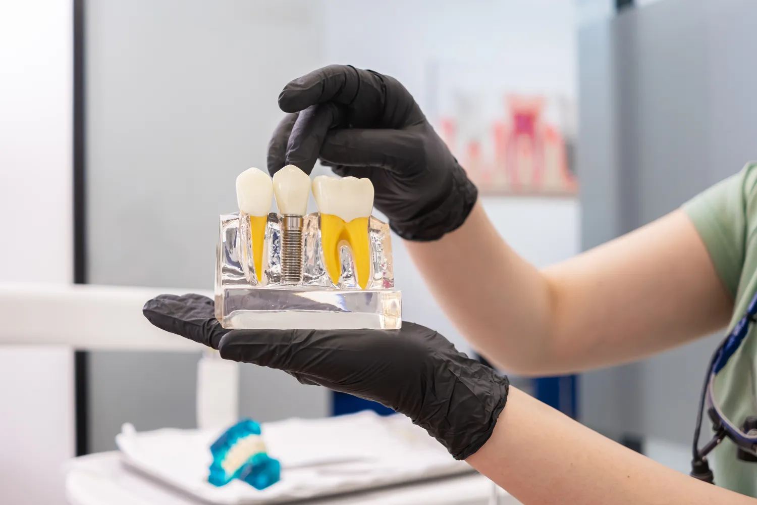 Leczenie kanałowe ile trwa?