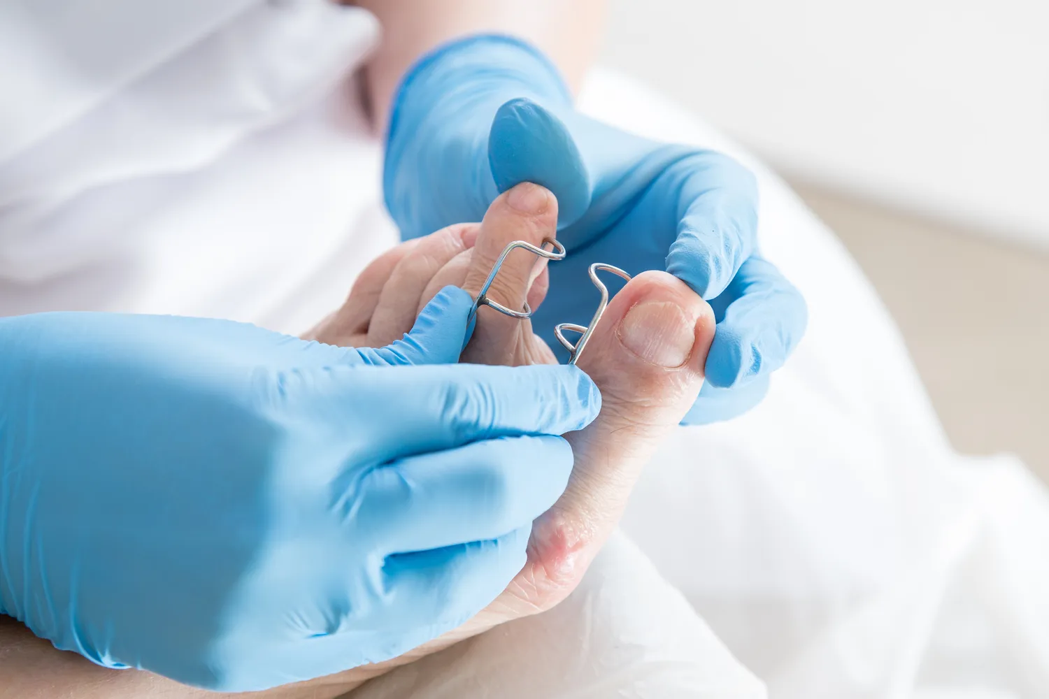 Hurtowania podologiczna